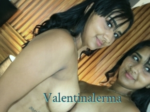 Valentinalerma