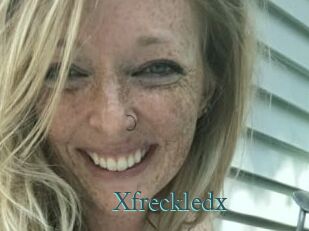 Xfreckledx